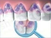 Płukanka wykrywająca osad AGENT PLAQUE - 2